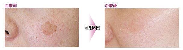 3�����Ԍ�̖����̎���